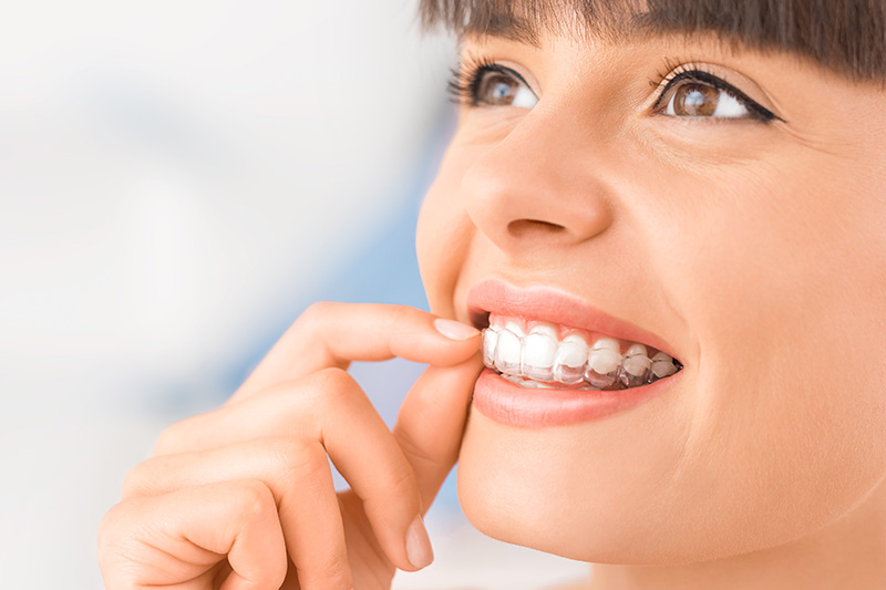 Orthodontics in La Mirada