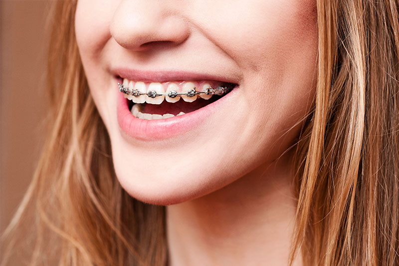 Orthodontics in La Mirada